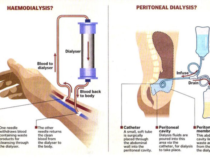What is the procedure of dialysis?
