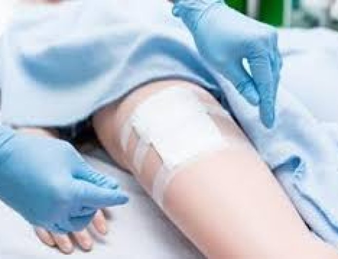 Wound Dressing and Management scenario based