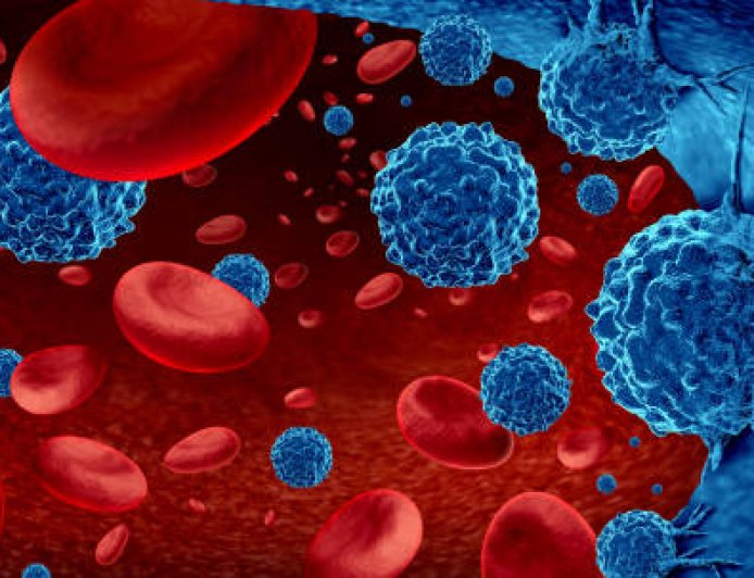 Short Questions for Leukemia (Medical Lab Technology) Students