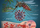 Dengue Disease its causes sign symptoms